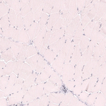 CD21 Antibody in Immunohistochemistry (Paraffin) (IHC (P))