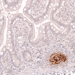 CD21 Antibody in Immunohistochemistry (Paraffin) (IHC (P))