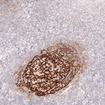 CD21 Antibody in Immunohistochemistry (Paraffin) (IHC (P))