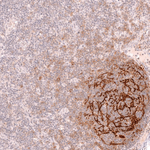 CD21 Antibody in Immunohistochemistry (Paraffin) (IHC (P))