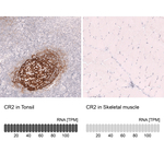 CD21 Antibody in Immunohistochemistry (Paraffin) (IHC (P))