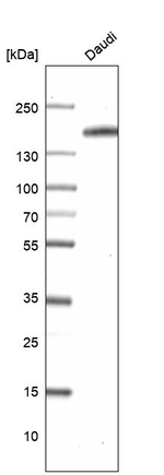CD21 Antibody in Western Blot (WB)