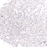 BRG1 Antibody in Immunohistochemistry (Paraffin) (IHC (P))