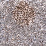 BRG1 Antibody in Immunohistochemistry (Paraffin) (IHC (P))