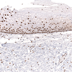 BRG1 Monoclonal Antibody (CL13783)