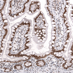 BRG1 Antibody in Immunohistochemistry (Paraffin) (IHC (P))