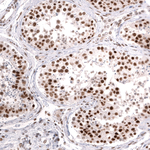 BRG1 Antibody in Immunohistochemistry (Paraffin) (IHC (P))