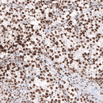 BRG1 Antibody in Immunohistochemistry (Paraffin) (IHC (P))