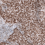 BRG1 Antibody in Immunohistochemistry (Paraffin) (IHC (P))