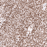 BRG1 Antibody in Immunohistochemistry (Paraffin) (IHC (P))