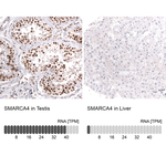 BRG1 Antibody in Immunohistochemistry (Paraffin) (IHC (P))