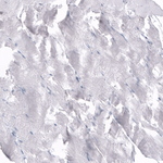 Osteopontin Antibody in Immunohistochemistry (Paraffin) (IHC (P))