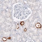 Osteopontin Antibody in Immunohistochemistry (Paraffin) (IHC (P))