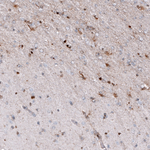 Osteopontin Antibody in Immunohistochemistry (Paraffin) (IHC (P))
