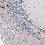 Osteopontin Antibody in Immunohistochemistry (Paraffin) (IHC (P))