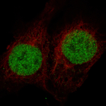 MSH2 Monoclonal Antibody (CL13713)