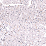 MSH2 Antibody in Immunohistochemistry (Paraffin) (IHC (P))