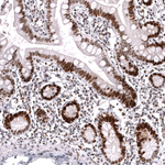 MSH2 Antibody in Immunohistochemistry (Paraffin) (IHC (P))