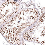 MSH2 Antibody in Immunohistochemistry (Paraffin) (IHC (P))