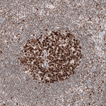 MSH2 Antibody in Immunohistochemistry (Paraffin) (IHC (P))