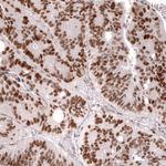 MSH2 Antibody in Immunohistochemistry (Paraffin) (IHC (P))