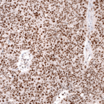 MSH2 Antibody in Immunohistochemistry (Paraffin) (IHC (P))