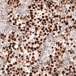 MSH2 Antibody in Immunohistochemistry (Paraffin) (IHC (P))