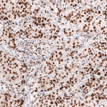 MSH2 Antibody in Immunohistochemistry (Paraffin) (IHC (P))