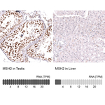 MSH2 Antibody in Immunohistochemistry (Paraffin) (IHC (P))