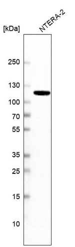 MSH2 Antibody in Western Blot (WB)