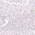 MSH2 Antibody in Immunohistochemistry (Paraffin) (IHC (P))
