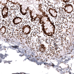 MSH2 Antibody in Immunohistochemistry (Paraffin) (IHC (P))