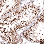 MSH2 Antibody in Immunohistochemistry (Paraffin) (IHC (P))