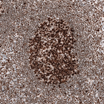 MSH2 Antibody in Immunohistochemistry (Paraffin) (IHC (P))