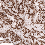 MSH2 Antibody in Immunohistochemistry (Paraffin) (IHC (P))