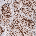 MSH2 Antibody in Immunohistochemistry (Paraffin) (IHC (P))