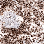 MSH2 Antibody in Immunohistochemistry (Paraffin) (IHC (P))