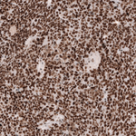 MSH2 Antibody in Immunohistochemistry (Paraffin) (IHC (P))