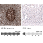 MSH2 Antibody in Immunohistochemistry (Paraffin) (IHC (P))