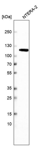 MSH2 Antibody in Western Blot (WB)