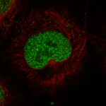 MSH2 Monoclonal Antibody (CL13764)