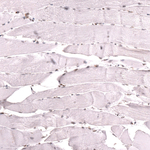 MSH2 Antibody in Immunohistochemistry (Paraffin) (IHC (P))