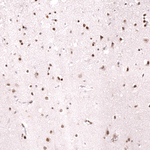MSH2 Antibody in Immunohistochemistry (Paraffin) (IHC (P))