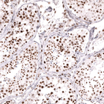 MSH2 Antibody in Immunohistochemistry (Paraffin) (IHC (P))