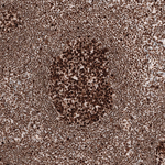 MSH2 Antibody in Immunohistochemistry (Paraffin) (IHC (P))