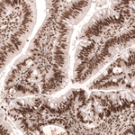MSH2 Antibody in Immunohistochemistry (Paraffin) (IHC (P))