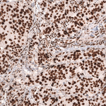 MSH2 Antibody in Immunohistochemistry (Paraffin) (IHC (P))
