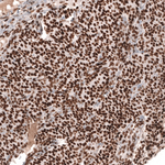 MSH2 Antibody in Immunohistochemistry (Paraffin) (IHC (P))