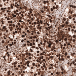 MSH2 Antibody in Immunohistochemistry (Paraffin) (IHC (P))