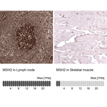 MSH2 Antibody in Immunohistochemistry (Paraffin) (IHC (P))